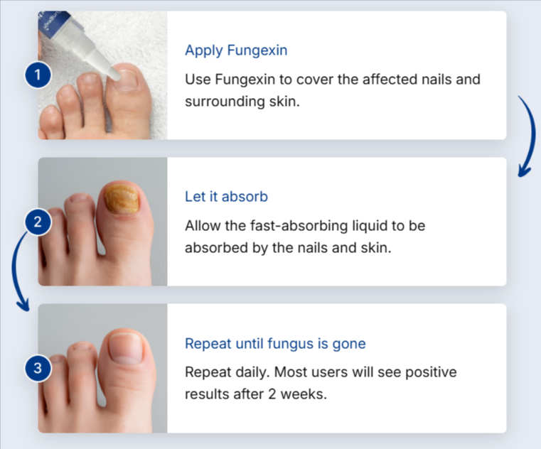 Fungexin Fungus Pen How to Use